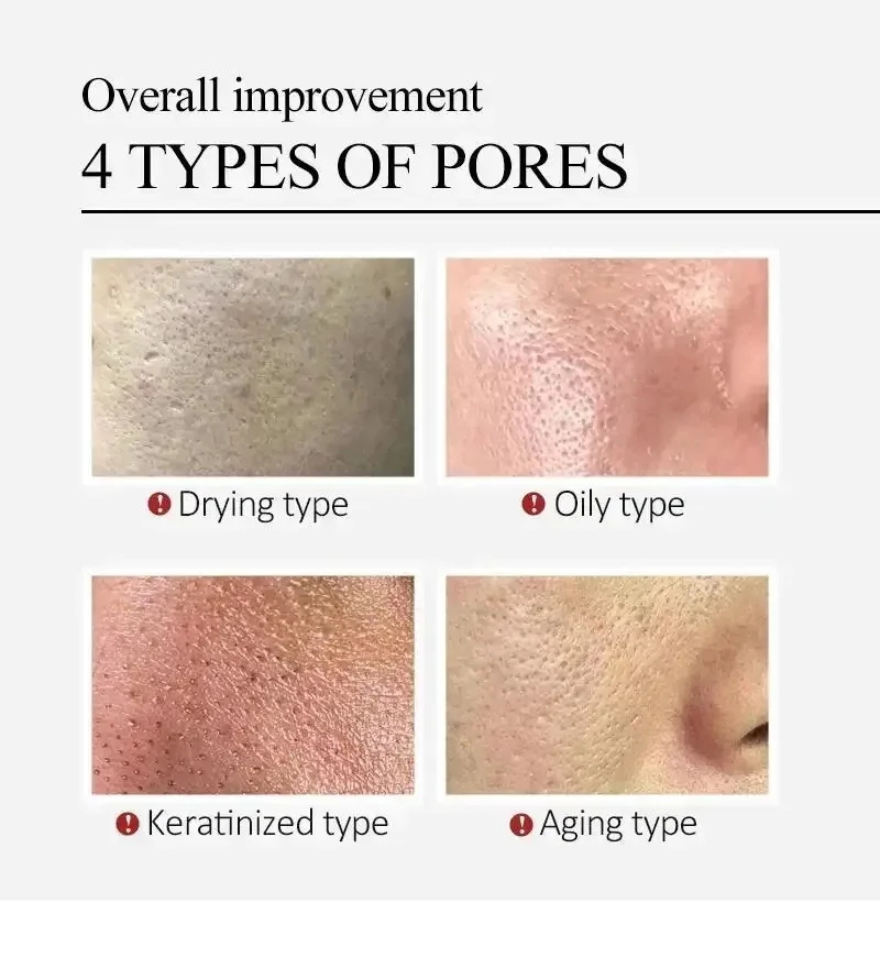 Centella Asiatica Shrink Pores – обзор и цена Luxury Skincare Korea